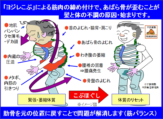 頭が大きい 地肌が硬い 小顔になりたい こぶほぐし くせ毛 薄毛 こぶ体質 がヤバイ 体調不良 脳疲労 デカ頭 不眠 こぶ体質特有 のお悩み対策は こぶほぐし予防美容室へ